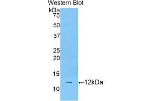 Detection of Recombinant DBI, Mouse using Polyclonal Antibody to Diazepam Binding Inhibitor (DBI) (Diazepam Binding Inhibitor antibody  (AA 2-87))