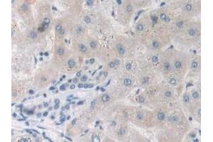 Immunohistochemistry (IHC) image for anti-Tumor Necrosis Factor alpha (TNF alpha) (AA 77-233) antibody (ABIN7429988)
