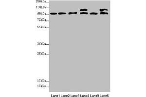 Western blot All lanes: NAA25 antibody at 2. (NAA25 antibody  (AA 703-972))