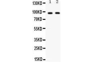 Western Blotting (WB) image for anti-CD22 Molecule (CD22) (AA 696-724), (C-Term) antibody (ABIN3043390) (CD22 antibody  (C-Term))