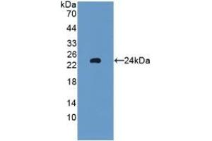 Detection of Recombinant GPX5, Rat using Polyclonal Antibody to Glutathione Peroxidase 5 (GPX5) (GPX5 antibody  (AA 22-221))