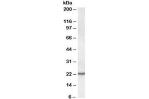 Western blot testing of NIH3T3 lysate with SAR1 antibody at 0. (SAR1A antibody)
