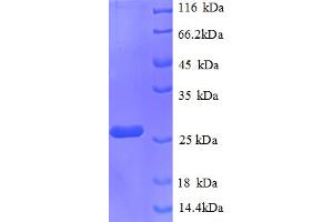 SDS-PAGE (SDS) image for Chorionic Somatomammotropin Hormone 1 (Placental Lactogen) (CSH1) (AA 27-217) protein (His tag) (ABIN5712772)