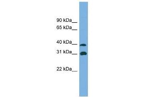 Crystallin Mu antibody used at 1 ug/ml to detect target protein. (CRYM antibody  (Middle Region))