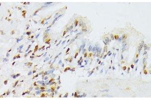 Immunohistochemistry of paraffin-embedded Rat lung using ANKRD52 Polyclonal Antibody at dilution of 1:100 (40x lens).
