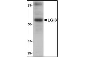Western blot analysis of LGI3 in human brain tissue lysate with LGI3 antibody at 1 µg/ml. (LGI3 antibody  (Center))