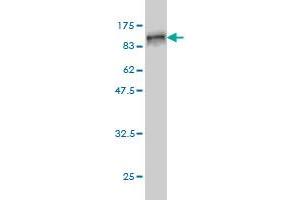 Western Blot detection against Immunogen (89. (Radixin antibody  (AA 1-583))
