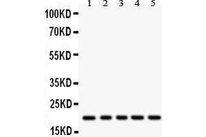 Anti- RAC1 Picoband antibody, Western blotting All lanes: Anti RAC1  at 0. (RAC1 antibody  (C-Term))