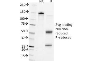 SDS-PAGE Analysis Purified CD45 Mouse Monoclonal Antibody (Bra55).