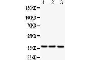 Western Blotting (WB) image for anti-CD79b Molecule, Immunoglobulin-Associated beta (CD79B) (AA 29-229) antibody (ABIN3043398)