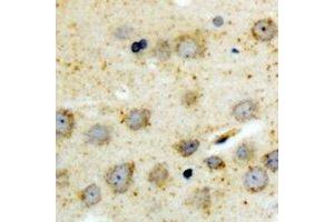 Immunohistochemical analysis of BID (pS78) staining in human brain formalin fixed paraffin embedded tissue section. (BID antibody  (pSer78))