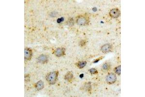 Immunohistochemical analysis of BID (pS78) staining in human brain formalin fixed paraffin embedded tissue section.