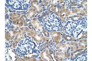 SOD1 antibody was used for immunohistochemistry at a concentration of 4-8 ug/ml to stain Epithelial cells of renal tubule (arrows) in Human Kidney.