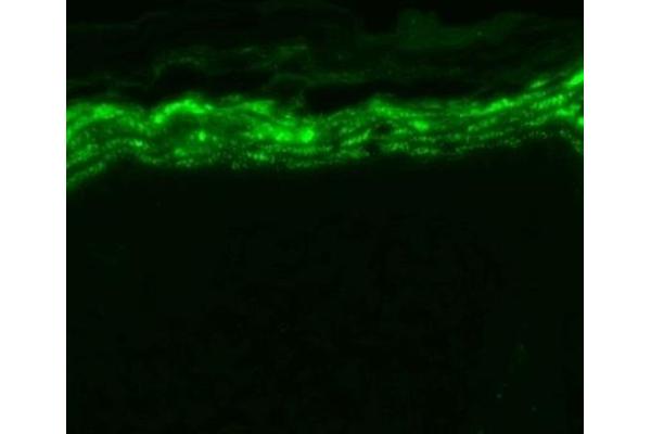 SCN9A antibody  (AA 1751-1946)
