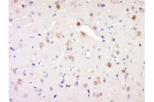 Paraformaldehyde-fixed, paraffin embedded rat brain, Antigen retrieval by boiling in sodium citrate buffer (pH6) for 15min, Block endogenous peroxidase by 3% hydrogen peroxide for 30 minutes, Blocking buffer (normal goat serum) at 37°C for 20min, Antibody incubation with Synaptojanin 1 Antibody, Unconjugated  at 1:200 overnight at 4°C, followed by a conjugated secondary and DAB staining. (Synaptojanin 1 antibody  (AA 481-580))