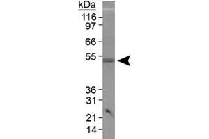 Western blot analysis of PLIN3 in 3T3-L1 lysate using PLIN3 polyclonal antibody . (PLIN3 antibody  (AA 350-435))