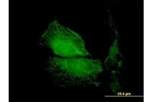 Immunofluorescence of purified MaxPab antibody to TMOD1 on HeLa cell. (Tropomodulin 1 antibody  (AA 1-359))