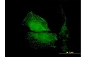 Immunofluorescence of purified MaxPab antibody to TMOD1 on HeLa cell.