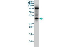 EDA2R monoclonal antibody (M02), clone 3C1. (Ectodysplasin A2 Receptor antibody  (AA 1-110))