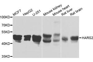 Western blot analysis of extracts of various cells, using HARS2 antibody. (HARS2 antibody)