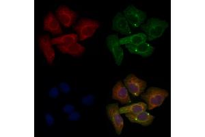 ABIN6265691 and ABIN6276606 staining Hela cells by IF/ICC. (TPM3 antibody  (N-Term))