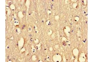 Immunohistochemistry of paraffin-embedded human brain tissue using ABIN7165071 at dilution of 1:100 (PRMT5 antibody  (AA 297-534))