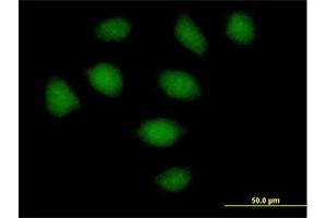 Immunofluorescence of purified MaxPab antibody to SECISBP2 on HeLa cell. (SECISBP2 antibody  (AA 1-854))
