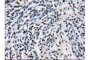 Immunohistochemical staining of paraffin-embedded Ovary tissue using anti-LEMD3mouse monoclonal antibody.