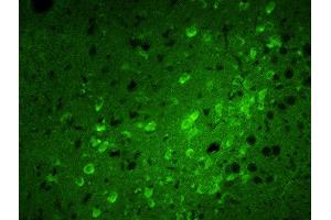 Formalin-fixed and paraffin embedded rat brain labeled with Rabbit Anti-Calreticulin Polyclonal Antibody, FITC Conjugated  at 1:100 for 40 minutes at 37°C. (Calreticulin antibody  (AA 101-200) (FITC))