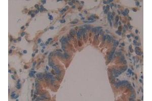 Detection of BFP in Rat Lung Tissue using Polyclonal Antibody to Brain Finger Protein (BFP)
