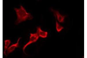 OR51B6 antibody  (N-Term)