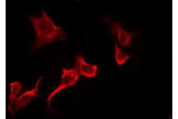 OR51B6 antibody  (N-Term)