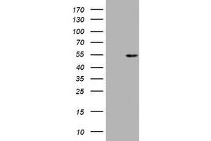 Image no. 1 for anti-Vimentin (VIM) (AA 210-466) antibody (ABIN1491204) (Vimentin antibody  (AA 210-466))