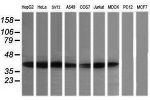 Image no. 3 for anti-Mitogen-Activated Protein Kinase Kinase 3 (MAP2K3) antibody (ABIN1499401)
