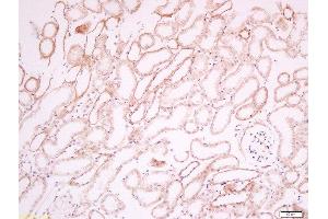 Paraformaldehyde-fixed, paraffin embedded mouse kidney tissue, Antigen retrieval by boiling in sodium citrate buffer(pH6) for 15min, Block endogenous peroxidase by 3% hydrogen peroxide for 30 minutes, Blocking buffer (normal goat serum) at 37°C for 20min, Antibody incubation with Rabbit Anti-CD34 Polyclonal Antibody, Unconjugated  at 1:200 overnight at 4°C, followed by a conjugated secondary and DAB staining (CD34 antibody  (AA 210-260))