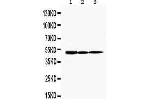 Western blot analysis of KIM1 using anti-KIM1 antibody . (HAVCR1 antibody  (C-Term))