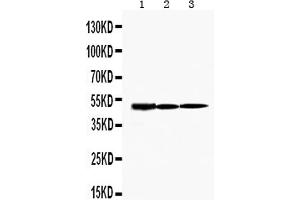 Western blot analysis of KIM1 using anti-KIM1 antibody .