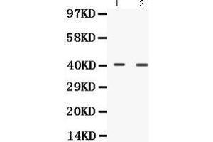 Western Blotting (WB) image for anti-NDRG Family Member 2 (NDRG2) (AA 210-247), (C-Term) antibody (ABIN3043261) (NDRG2 antibody  (C-Term))