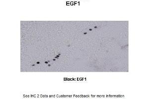Sample Type :  Frog brain  Primary Antibody Dilution :  1:500  Secondary Antibody :  Biotinylated goat anti-rabbit  Secondary Antibody Dilution :  1:200  Color/Signal Descriptions :  Black: EGF1  Gene Name :  EGR1 a  Submitted by :  Eva Fischer, Colorado State University (EGR1 antibody  (N-Term))