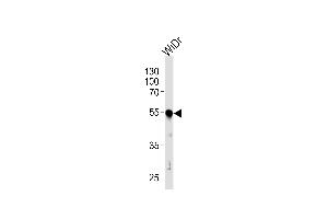 Western blot analysis of lysate from WiDr cell line, using hPDX1 (ABIN388773 and ABIN2839108). (PDX1 antibody  (C-Term))