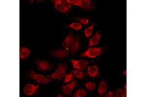 ABIN6266939 staining HepG2 by IF/ICC. (DLEC1 antibody  (N-Term))