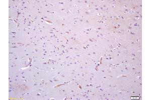 Formalin-fixed and paraffin embedded human brain with labeled Anti-TIE1 Polyclonal Antibody, Unconjugated (ABIN675099) at 1:200, followed by conjugation to the secondary antibody and DAB staining