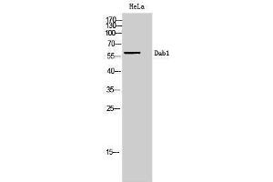 Western Blotting (WB) image for anti-Disabled Homolog 1 (Drosophila) (DAB1) (Ser295) antibody (ABIN3184243) (DAB1 antibody  (Ser295))