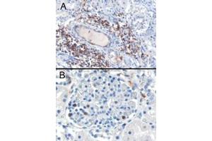 ABIN185183 (0. (SH3BP1 antibody  (C-Term))