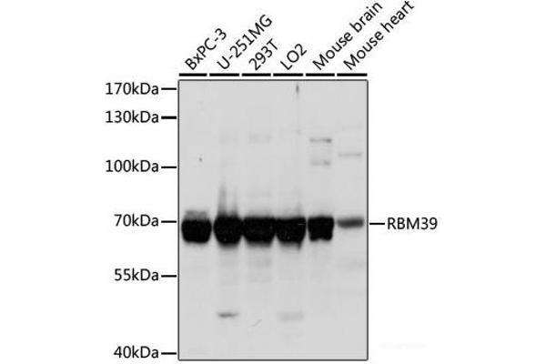 RBM39 antibody