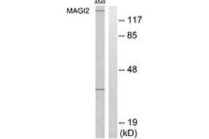 Western blot analysis of extracts from A549 cells, using MAGI2 Antibody. (MAGI2 antibody  (AA 221-270))