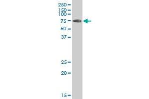 OCLN polyclonal antibody (A01), Lot # 051207JC01 Western Blot analysis of OCLN expression in Jurkat . (Occludin antibody  (AA 423-522))