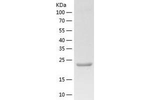 PZP Protein (AA 603-829) (His tag)