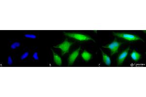 Immunocytochemistry/Immunofluorescence analysis using Rabbit Anti-Rab5 Polyclonal Antibody . (RAB5 antibody  (PerCP))