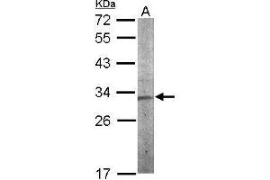Western Blotting (WB) image for anti-Charged Multivesicular Body Protein 5 (CHMP5) antibody (ABIN2856420)